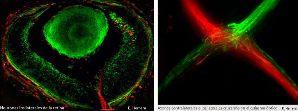 La proteína Zic2 actúa como un interruptor que apaga el programa genético que permite a los axones pasar al otro hemisferio cerebral