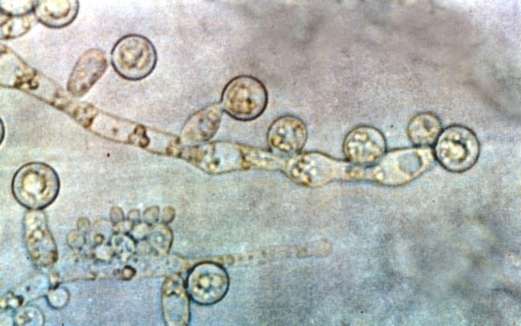 Biotecmed investiga una vacuna entrenada a partir del hongo Candida albicans. Foto de GrahamColm - Trabajo propio, CC BY-SA 3.0, https://commons.wikimedia.org/w/index.php?curid=10921762